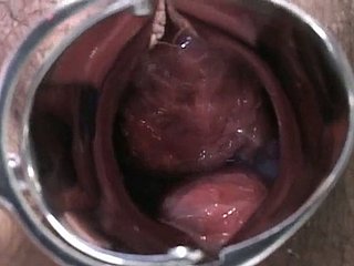 Senhora grávida japonês é examinado e suga lollicock do médico