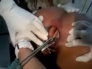 dildo removed detach from girl's anus