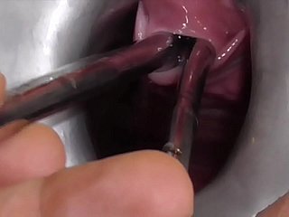 एमेच्योर Freyjaanalslut: एकाधिक ध्वनि - जेम्स कई ध्वनियों के साथ फ्रीजा के मूत्रमार्ग को खींच रहा है - फ्रीजा की गैपिंग योनी में पेशाब करना